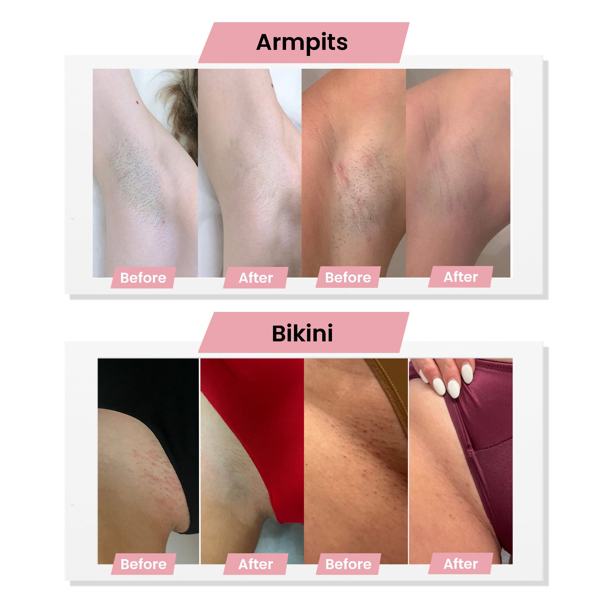 Bikini Trimmer