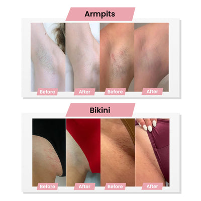 Bikini Trimmer